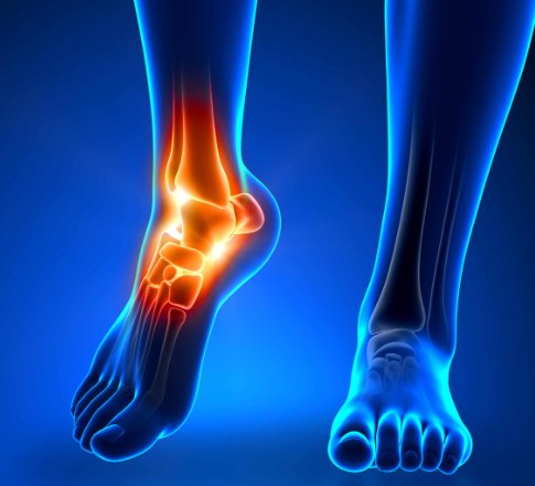 relieve-ankle-pain .png